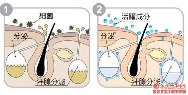 大连现代腋臭科:正视腋臭才能祛除臭味