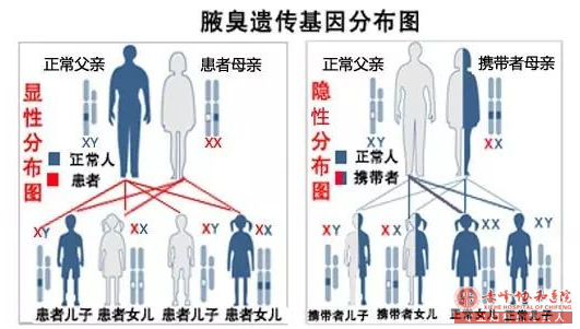 大连如何避免腋臭遗传?