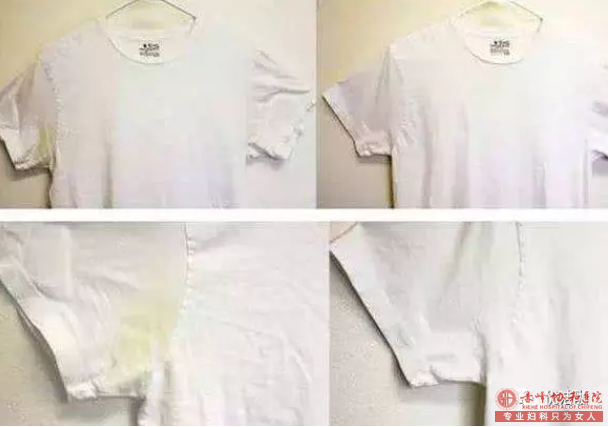 大连红山区自我诊断狐臭程度