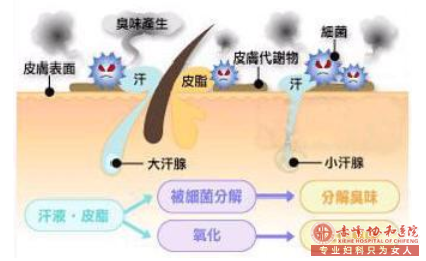 大连林西县微创治疗腋臭的费用是多少