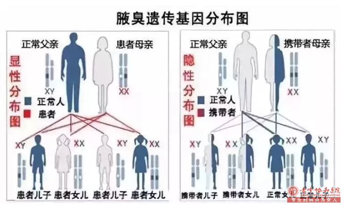 大连红山区腋毛下有粘稠液体是不是腋臭
