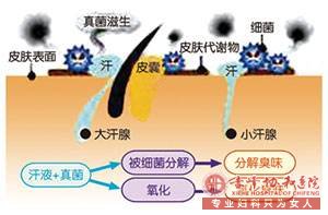 大连敖汉旗腋臭的四个判别标准